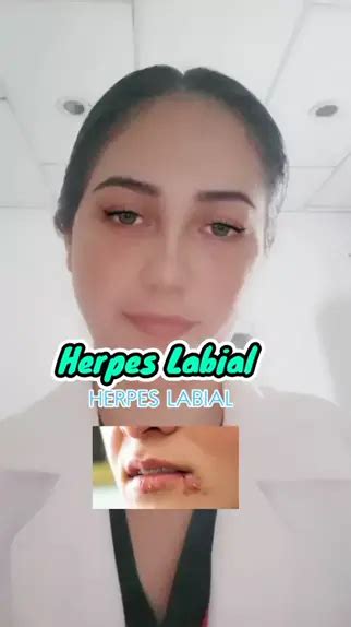 Herpes Labial Medicina Plata5 MiPaz ActitudVSAptitud Doctora