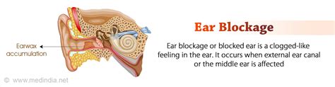 Ear Blockage | Wax Blockage - Glossary