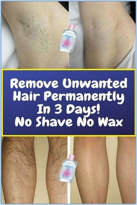 Remove Unwanted Hair Permanently Unwanted Hair Unwanted Hair Removal