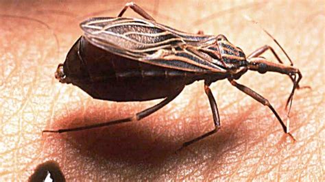 Chagas Disease Costamedic