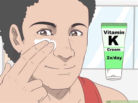 How To Get Rid Of A Bruise On Face Devicestructure13