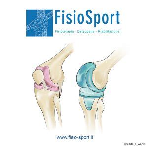 Protesi Ginocchio Fisiosport