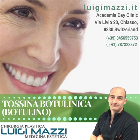 Dr Luigi Mazzi Tossina Botulinica Botulino Vie Le Rughe Dalla