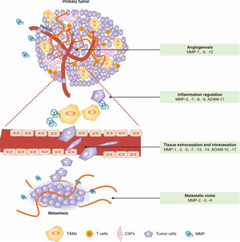 Tumor Progression And Metastasis Oncohema Key