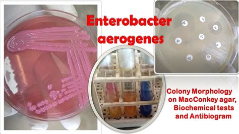 Enterobacter aerogenes Colony Morphology on MacConkey agar, Biochemical tests, and Antibiogram ...