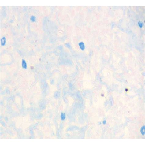 Toluidine Blue A And Alcian Blue Safranin B Staining Of Mast Cells