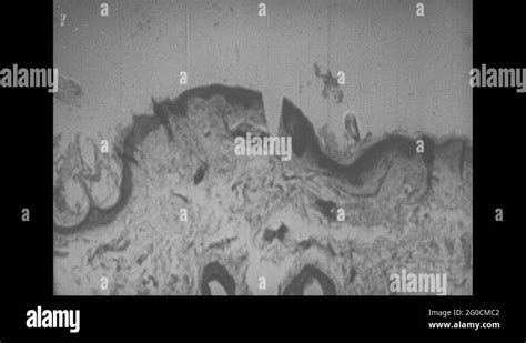 1950s United States Epidermis Under Microscope Cut In Skin Under
