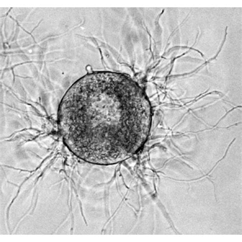 Хитридиомицеты Chytridiomycetes Lifecatalog