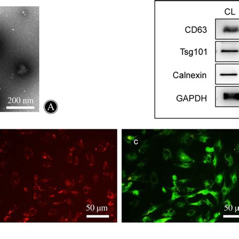 Identification Of Senescent Nucleus Pulposus Cell Npc‐derived Download Scientific Diagram