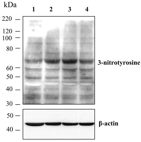 Peroxynitrite formation in retinal pericytes exposed to oxidized-LDL ...