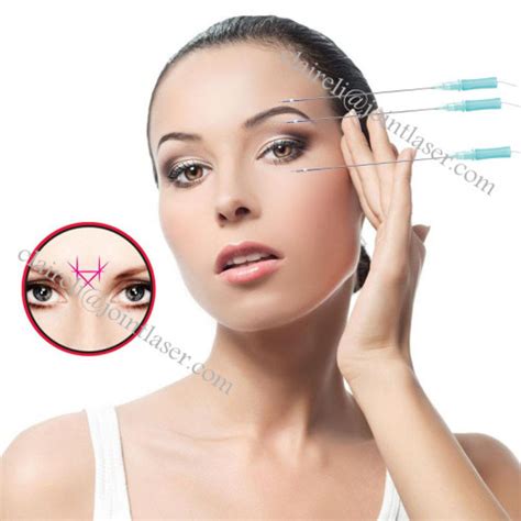 Pdo Thread Lift For Eyes Wrinkle Lifting 의 고품질 Pdo Thread