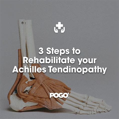 Achilles Tendinopathy Artofit