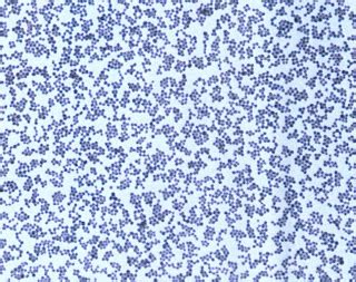 Sacrifices for the Love of Science: Staphylococcus epidermidis