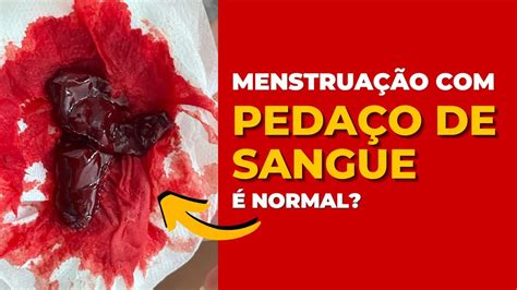 Menstruação Com Pedaços De Sangue é Normal Youtube