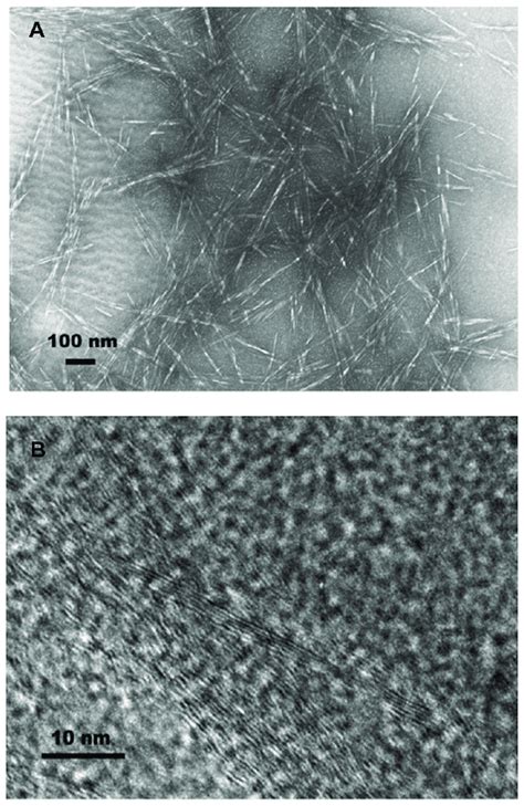 21 TEM A And HRTEM B Micrographs Of CNPs Reproduced From Ref 61