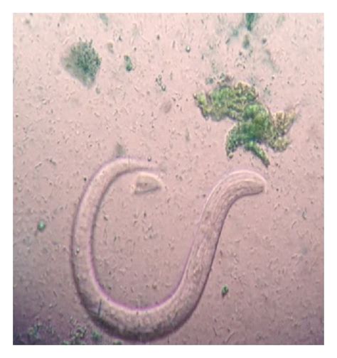 Hookworm Ova A Cyst Of Giardia Lamblia B Oocyst Of Isospora Belli Download Scientific