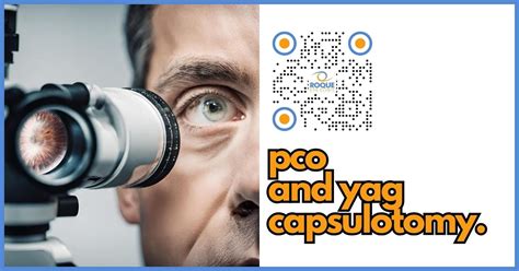 Understanding Posterior Capsule Opacification And Yag Laser Capsulotomy