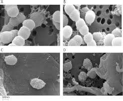 Rumen Microbes - Ruminococcus albus | Department of Animal Science