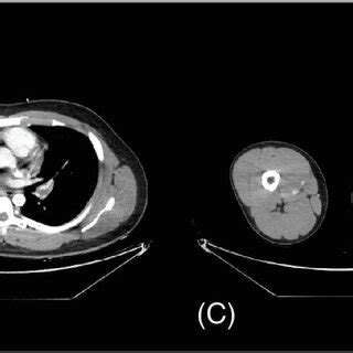 Computed tomography pulmonary angiography and venography images ...