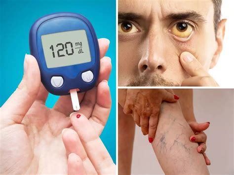 Diabetes Symptoms In Men Top 7 Unusual Signs Of Insulin Deficiency