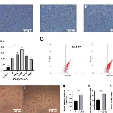 Lipus Promotes Osteogenic Differentiation Of Pdlscs A The Alp Mirna