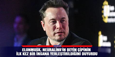 Elon Musk Neuralink In Beyin Ipinin Ilk Kez Bir Insana