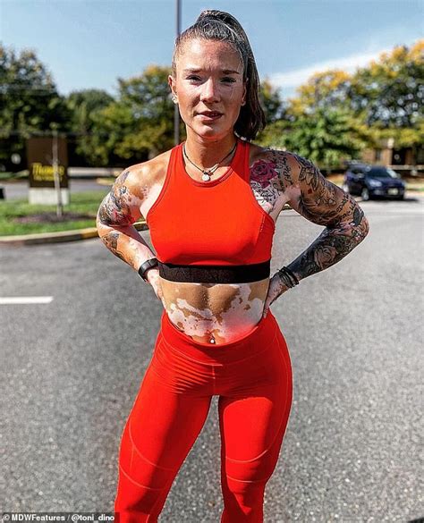 Vitiligo Sufferer Says Bodybuilding Helped Her To Embrace Her Skin