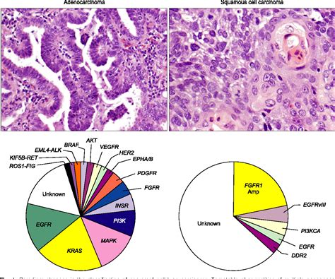 Pdf Molecular Abnormalities Of Squamous Cell Carcinomas And