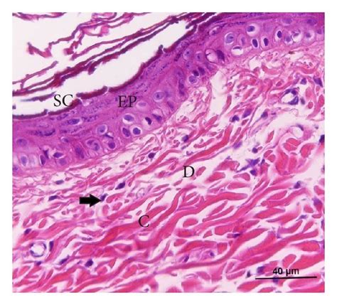 Histological Sections From The Wound Area Stained With Download