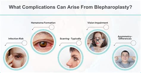 eyelid surgery  eye problems  detailed explanatio