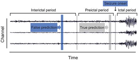 Frontiers Seizure Prediction In EEG Signals Using STFT And Domain