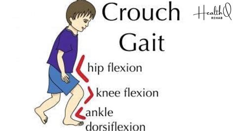 Exercises For Crouched Gait Youtube