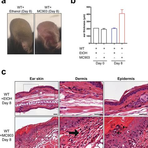 Th2 Cytokine Expression Is Similar Between MC903 Treated Mice Panel