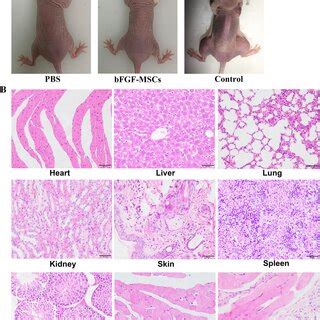 A Tumorigenesis Of BFGF HUCMSCs After Injection Into Nude Mice B H E