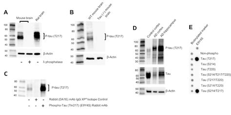 验证用于阿尔茨海默病研究的 P Tau217 单克隆抗体