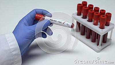 Negative Beta Hcg Test Doctor Showing Blood Sample In Tube Health