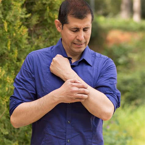 Winter Rashes - Forefront Dermatology