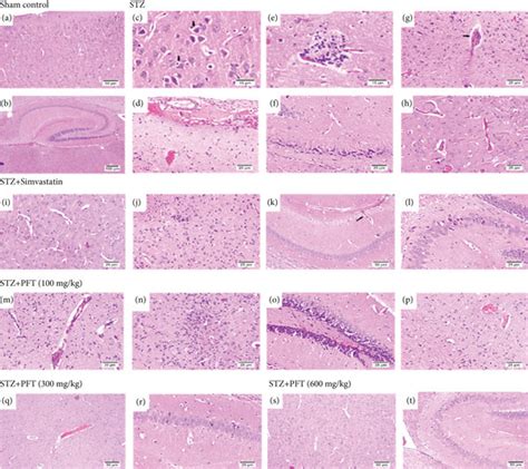 Histological Sections Of H And E Staining In The Cerebral Cortex And Download Scientific Diagram