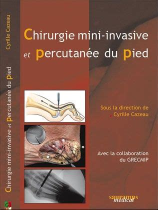 Chirurgie Mini Invasive Et Percutan E Du Pied