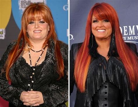 Wynonna Judd Weight Loss Before And After Pinterest Celebrity