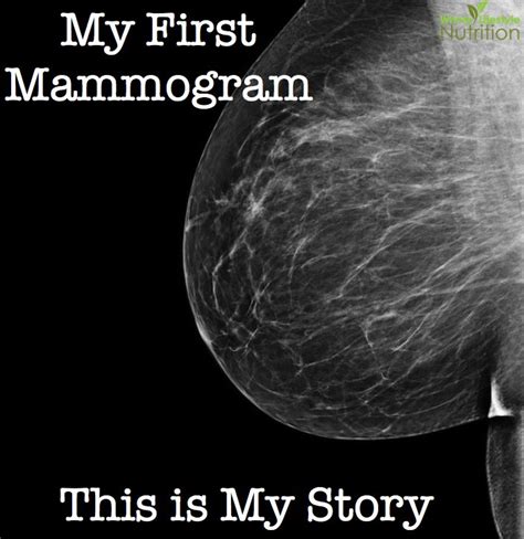 List 98 Images Mammogram Pictures Of Breast Cancer Completed