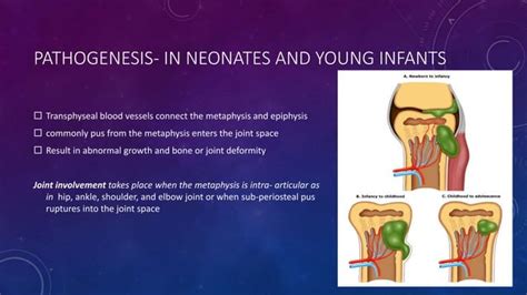 Hematogenous Osteomyelitis Ppt