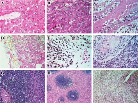 Pathology In Fatally Infected Cynomolgus Monkeys Tissues Were Obtained