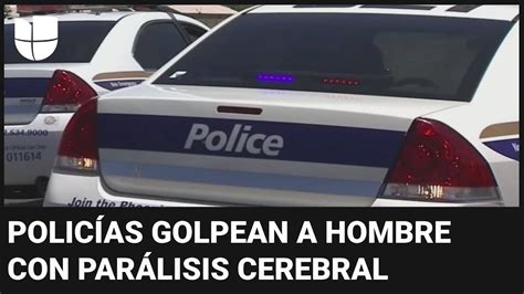 Violento arresto a un hombre sordo y con parálisis cerebral genera