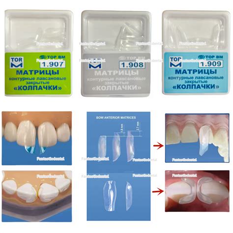 Dental Clear Matrix Tor Vm Matrice Anterior Matrices Bt Fit Bioclear L