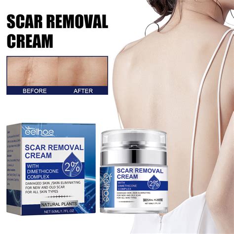 Deals Scar Removal Cream Scar Repair Cream Scar Removal And Skin Repair ...