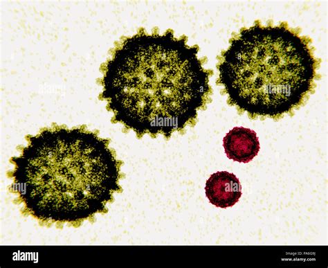 Hepatitis C Green And Polio Red Virus Particles Illustration Both