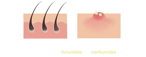 Home | NTHU_Taiwan - iGEM 2022 