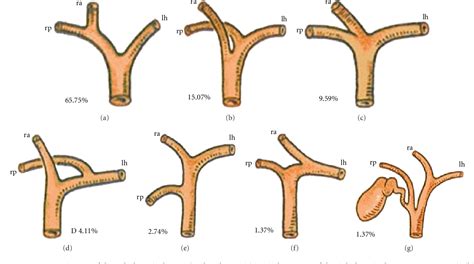 Hepatic Duct Anatomy Anatomical Charts Posters – NBKomputer