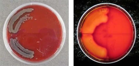 A Perfect Pathogen Storm Vibrio Bacteria Sargassum And Plastic